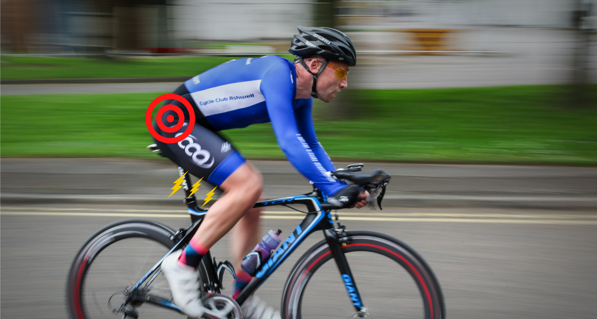 endofibrose illiaque chez le cycliste